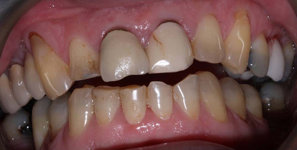 market-weighton-dental-services-cosmetic-dentistry-before01